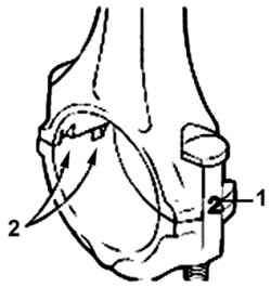 Расположение метки (1) с номером цилиндра на шатуне и крышке шатуна, а также выемок (2) для фиксации вкладыша подшипника